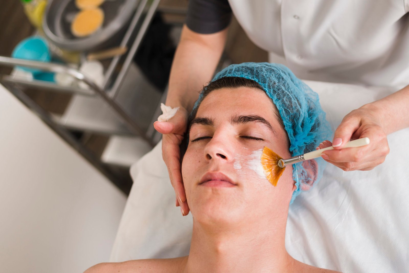 Chemical Peel treatment
