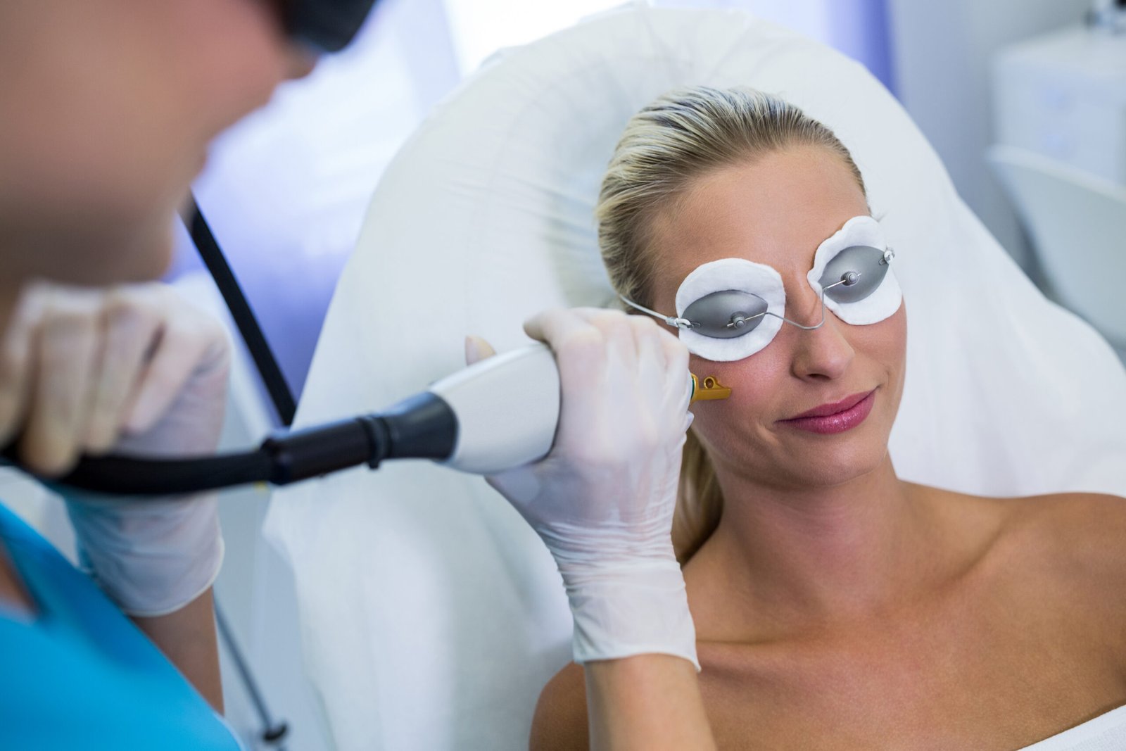 Lasers IQ Switch treatment